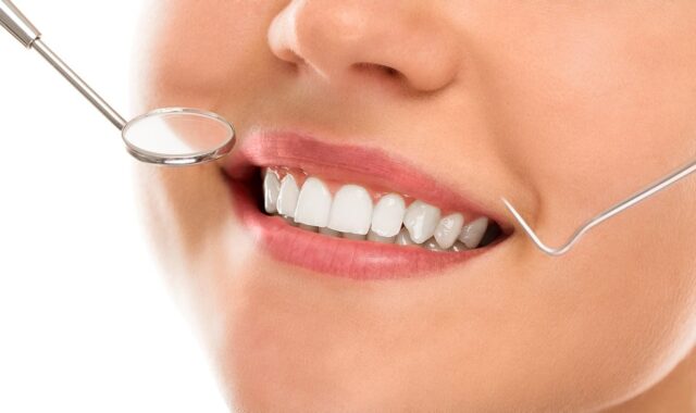 caries, checkup, clinic, clinical, close-up, closeup, cure, dental, dentist, dentistry, equipment, examine, filling, gum, heal, health, healthcare, healthy, human, hygiene, inspection, instrument, lips, macro, medic